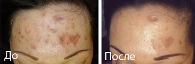 Фото из галереи