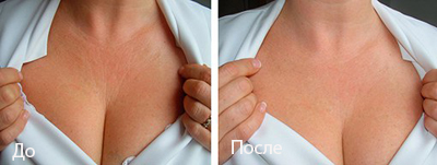Фото из галереи