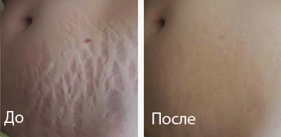 Фото из галереи